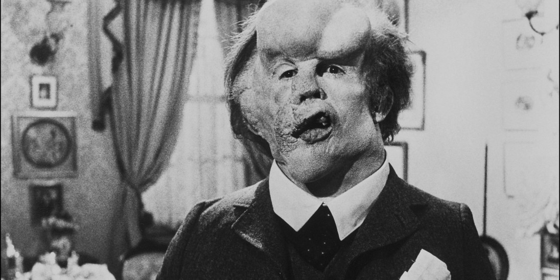 Xem phim Người Voi (The Elephant Man) 1980